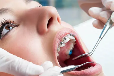 Aparelho Dentário em Guarulhos