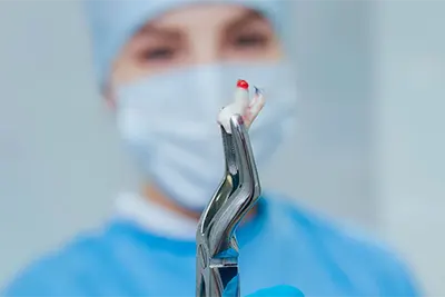 Cirurgia Dental em Guarulhos