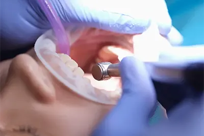 Cirurgia Dental em Guarulhos