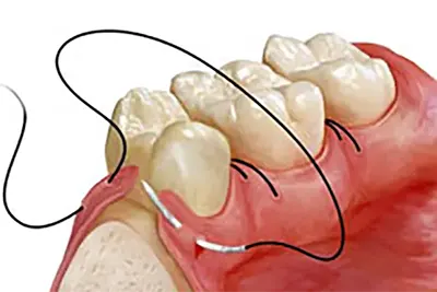 Cirurgia Dental em Guarulhos