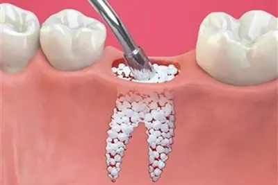 Cirurgia Odontológica em Guarulhos