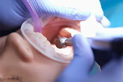 Cirurgião Dentista em Guarulhos