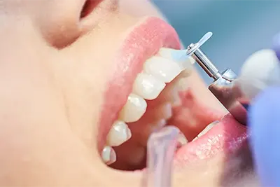 Cirurgião Dentista em Guarulhos