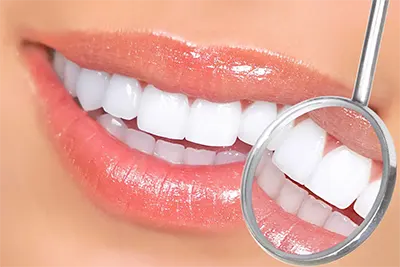 Clínica de Estética Dental