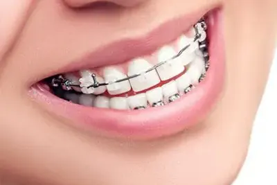 Dentista Ortodontia Guarulhos