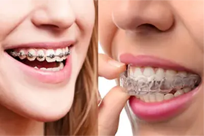 Dentista Ortodontia Guarulhos