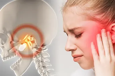 Disfunção Temporomandibular