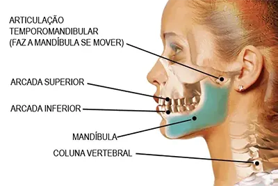 Disfunção Temporomandibular