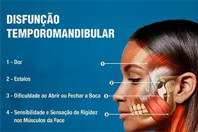Disfunção Temporomandibular em Guarulhos