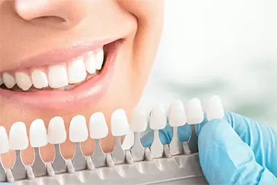Estética Dental em Guarulhos