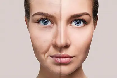 Harmonização Orofacial em Guarulhos