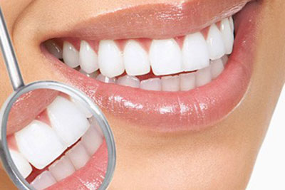 Limpeza Dentária em Guarulhos