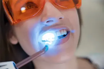 Orçamento Dentista Guarulhos