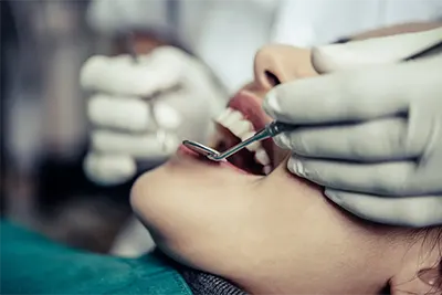 Restauração Dentária em Guarulhos