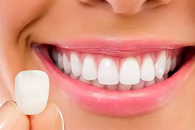 Tratamentos Odontológicos em Guarulhos