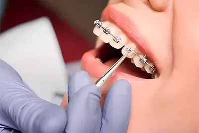 Tratamentos Odontológicos em Guarulhos